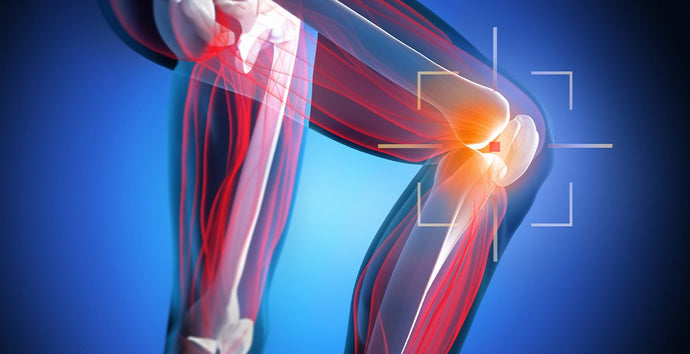 Guide to Meniscus Tear Recovery